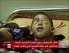 img_4bd72cba82_child_blind_gaza_dime_aljazeera.jpg